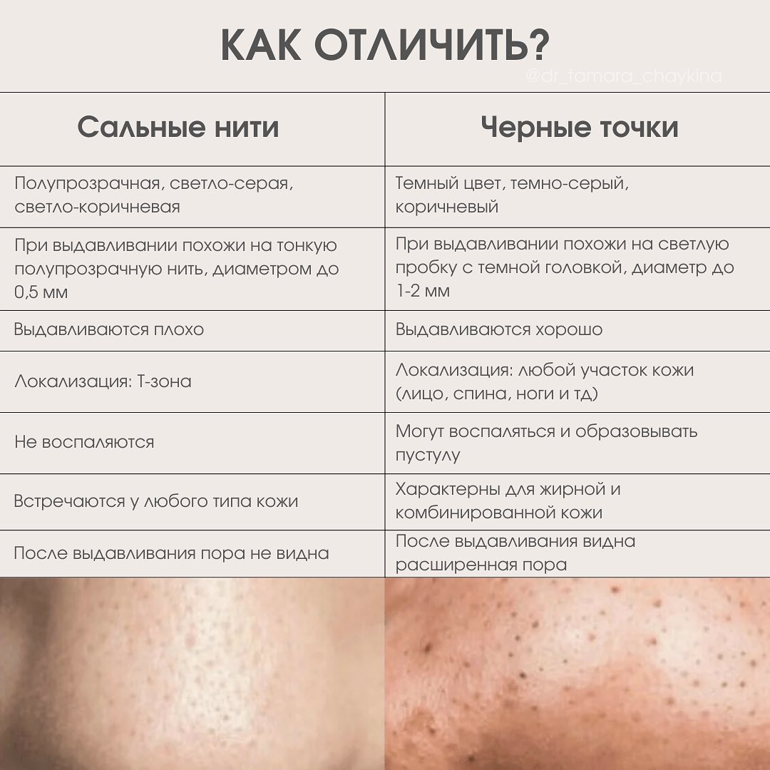 Не можете избавиться от точек на носу? Не можете избавиться от точек на носу?
